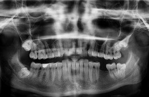radiografia