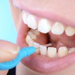 Placa dental